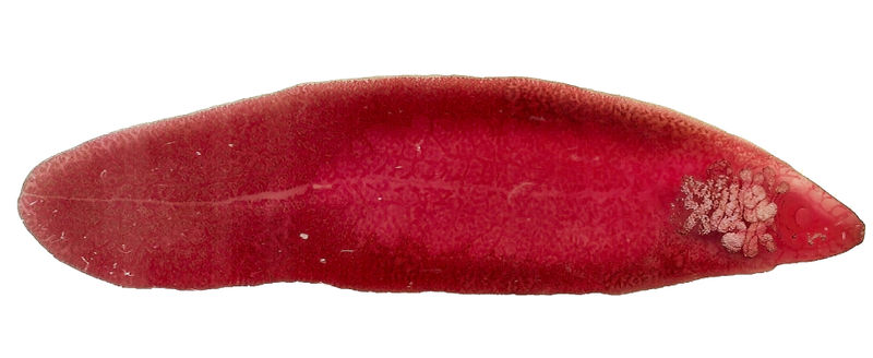 Bestand:Volwassen leverbot microscopisch 2.jpg