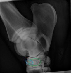 Augustus 2011: Hier zie je een gewricht dat duidelijk meer aan het dichtgroeien is. De gewrichtsspleet is bijna verdwenen (blauwe cirkel) en al geheel dichtgegroeid op onderdelen (groene kringel). Het bot ziet er ook veel rustiger uit (minder grijstinten en meer wittinten). Als de gewrichtspleet is dichtgegroeid is er vrijwel geen pijn. Bij dit paard zie je aan de zijkant vrijwel geen haken. De prognose voor dit paard om weer in de sport te kunnen lopen is zeer gunstig, maar dit kan per paard heel sterk verschillen.